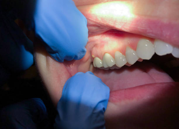 Best Broken or Cracked Tooth Emergency Dentist in Scott Af, IL