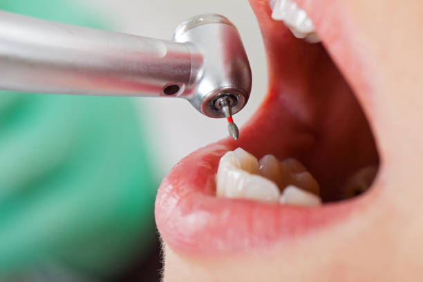 Best Holiday Emergency Dentist in Scott Af, IL